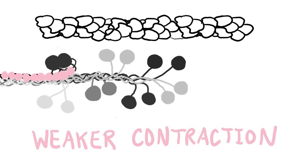 When MyBP-C sticks to myosin's neck, that myosin is "turned off" and cannot pull actin. This results in a weaker contraction.