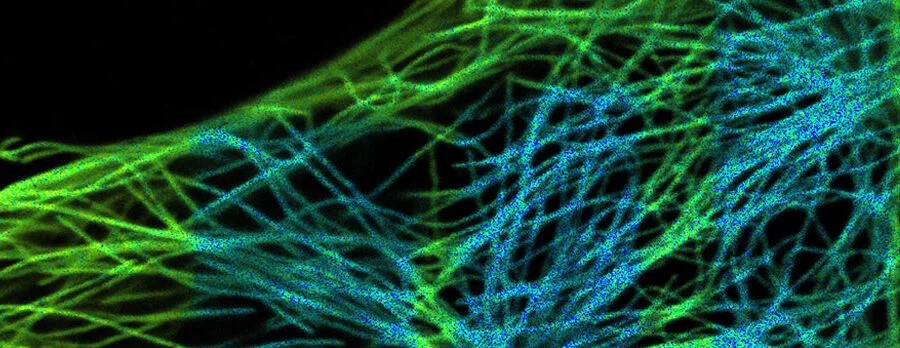 Image borrowed from https://www.leica-microsystems.com/science-lab/life-science/visualizing-protein-protein-interactions/ (decorative)